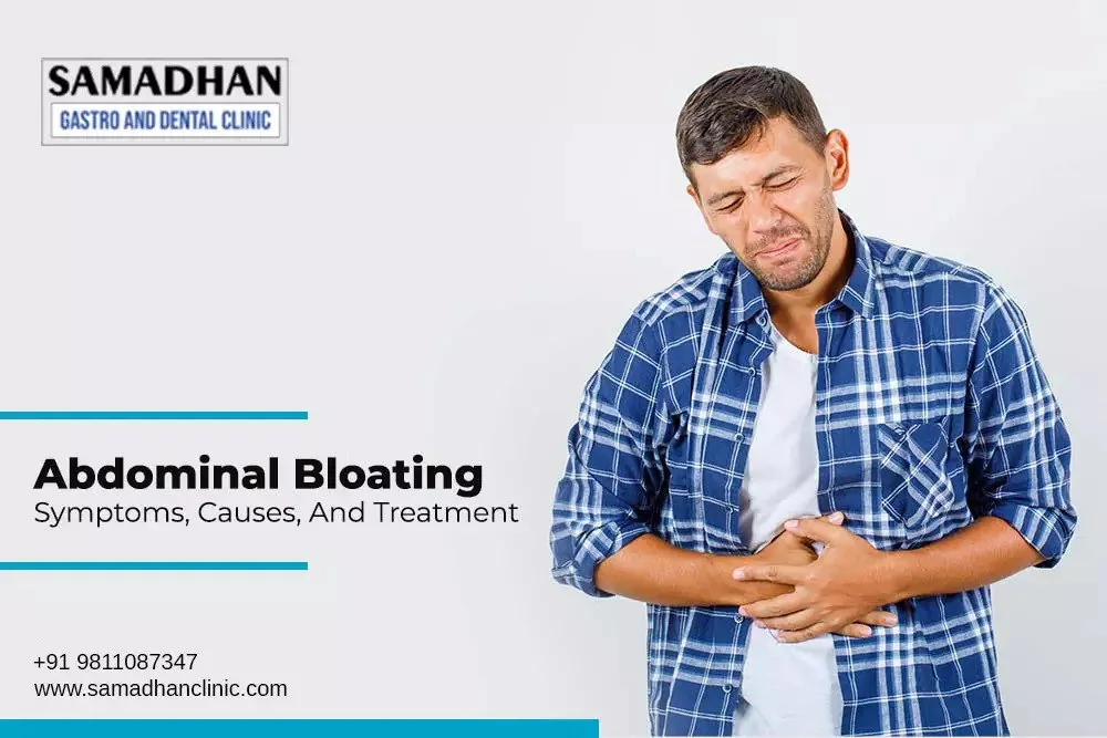 Abdominal Bloating