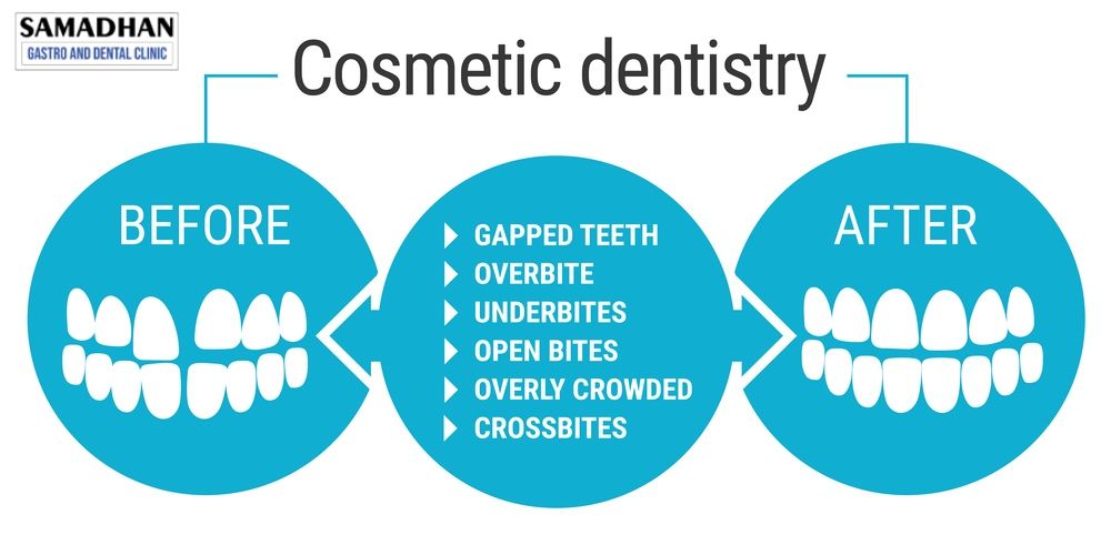Cosmetic Dentistry and Orthodontics Procedures at Samadhan Clinic, Dwarka