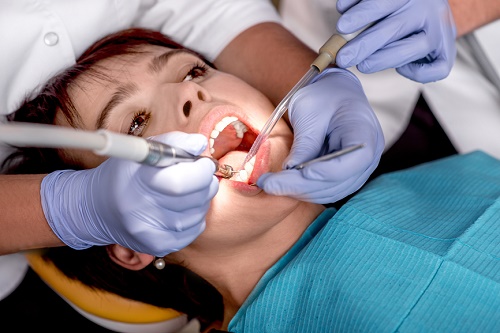 dental-erosion-by-dental-clinic-in-delhi