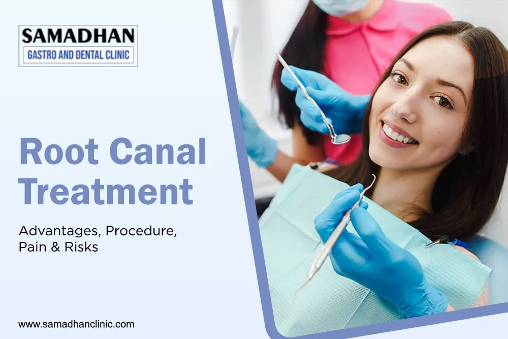 root canal treatment